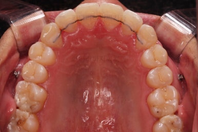 부산교정치과추천