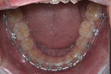 부산교정전문의