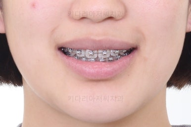 사직동교정치과