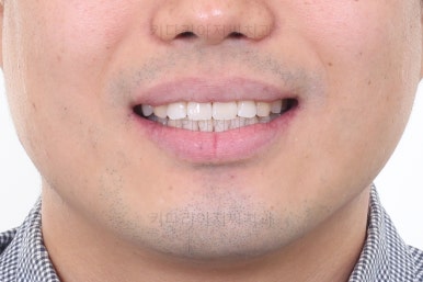 부산교정치과추천