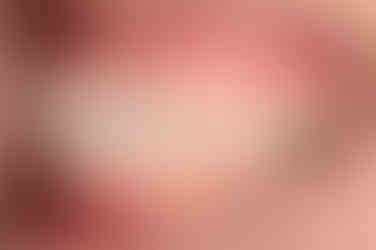 부산임플란트교정