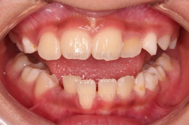 부산어린이교정