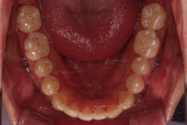 부산인비절라인