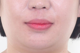 부산교정치과