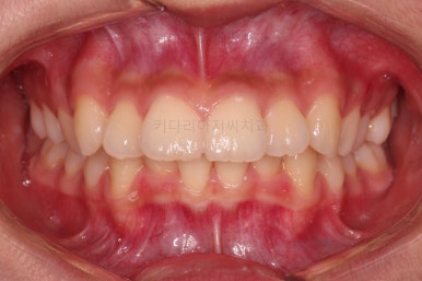 부산치아교정치과