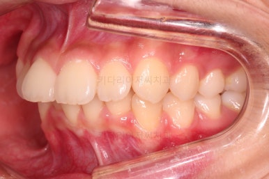 부산치아교정치과