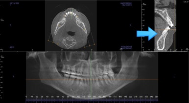부산연산동교정치과