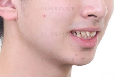 부산교정치과추천