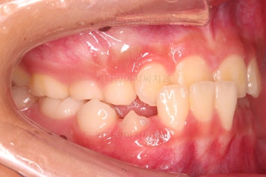 부산어린이교정