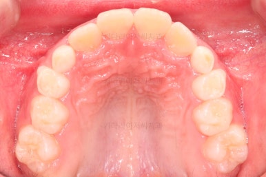 부산어린이교정