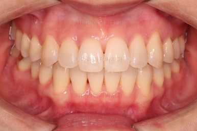 부산인비절라인