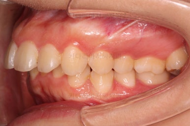 부산무턱교정치과