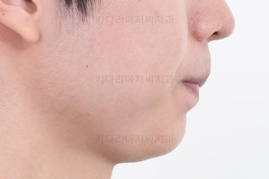 부산연제구교정