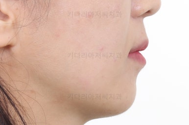 부산인비절라인