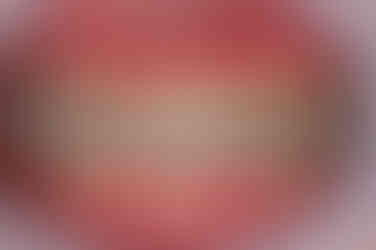 부산주걱턱교정