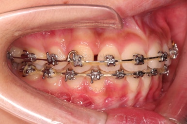 부산치아교정치과