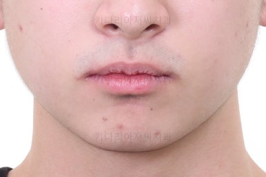 부산교정치과추천