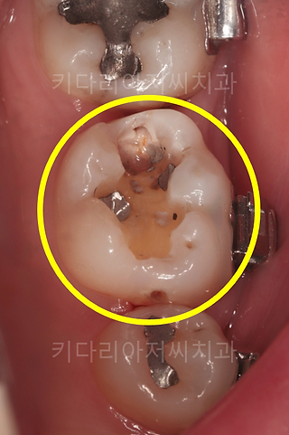 연산역치과