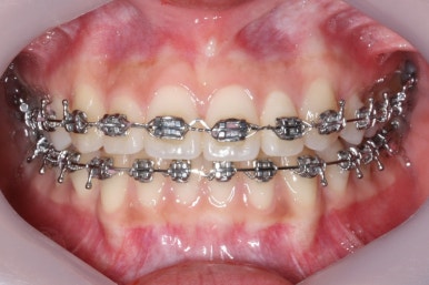 부산연산동청소년교정