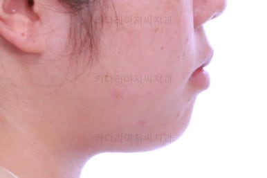 부산교정전문치과