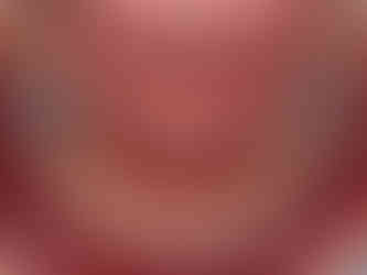 연산동치아교정