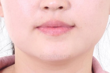 연산동교정치과