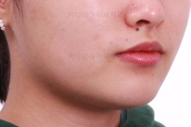 부산치아교정치과