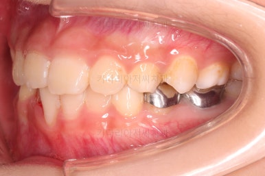 부산어린이교정
