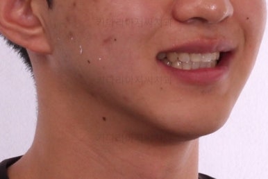 연산동교정전문치과