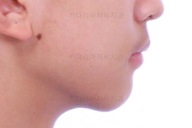 부산교정치과추천