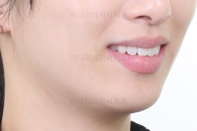 부산연산동부분교정