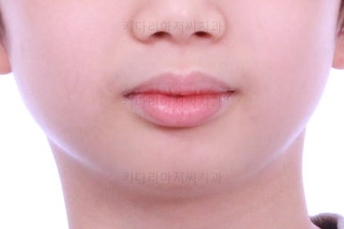 부산어린이교정
