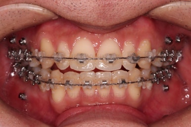 부산연제구교정