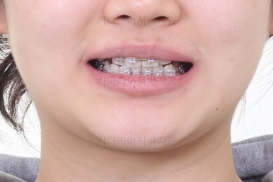 연산동교정치과