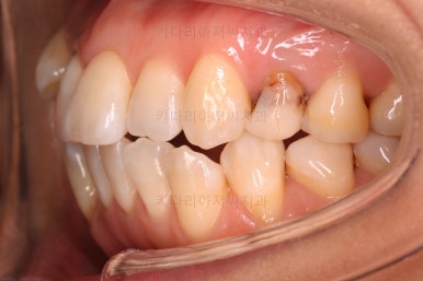 부산인비절라인