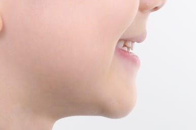부산어린이치아교정