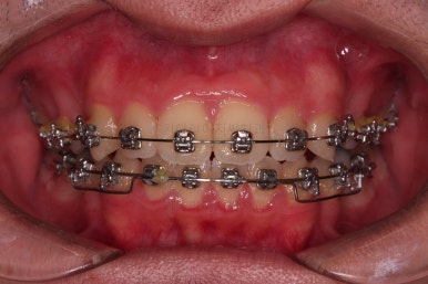 부산교정치과추천