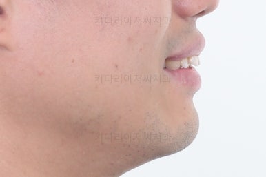 부산교정치과추천