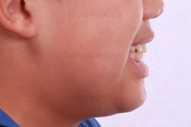 부산어린이교정