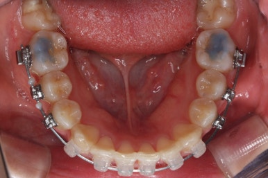 연산동교정치과