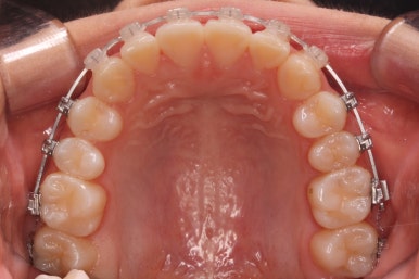 부산치아교정잘하는곳