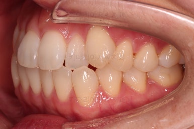 부산인비절라인