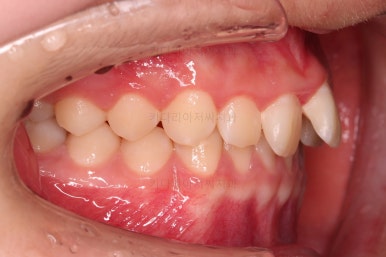 부산청소년교정치과