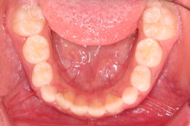 부산어린이교정