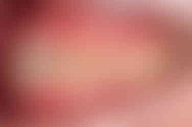 부산긴얼굴긴턱교정