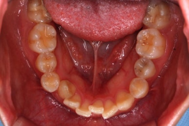 연산동교정치과