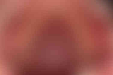 부산어린이치아교정