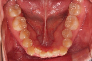 동래구치아교정