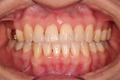 부산인비절라인