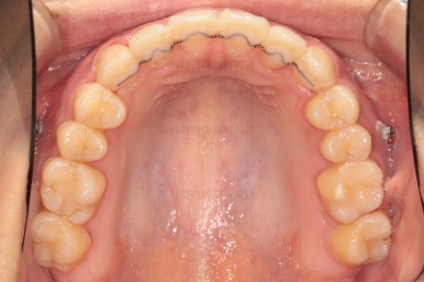 부산치아교정치과